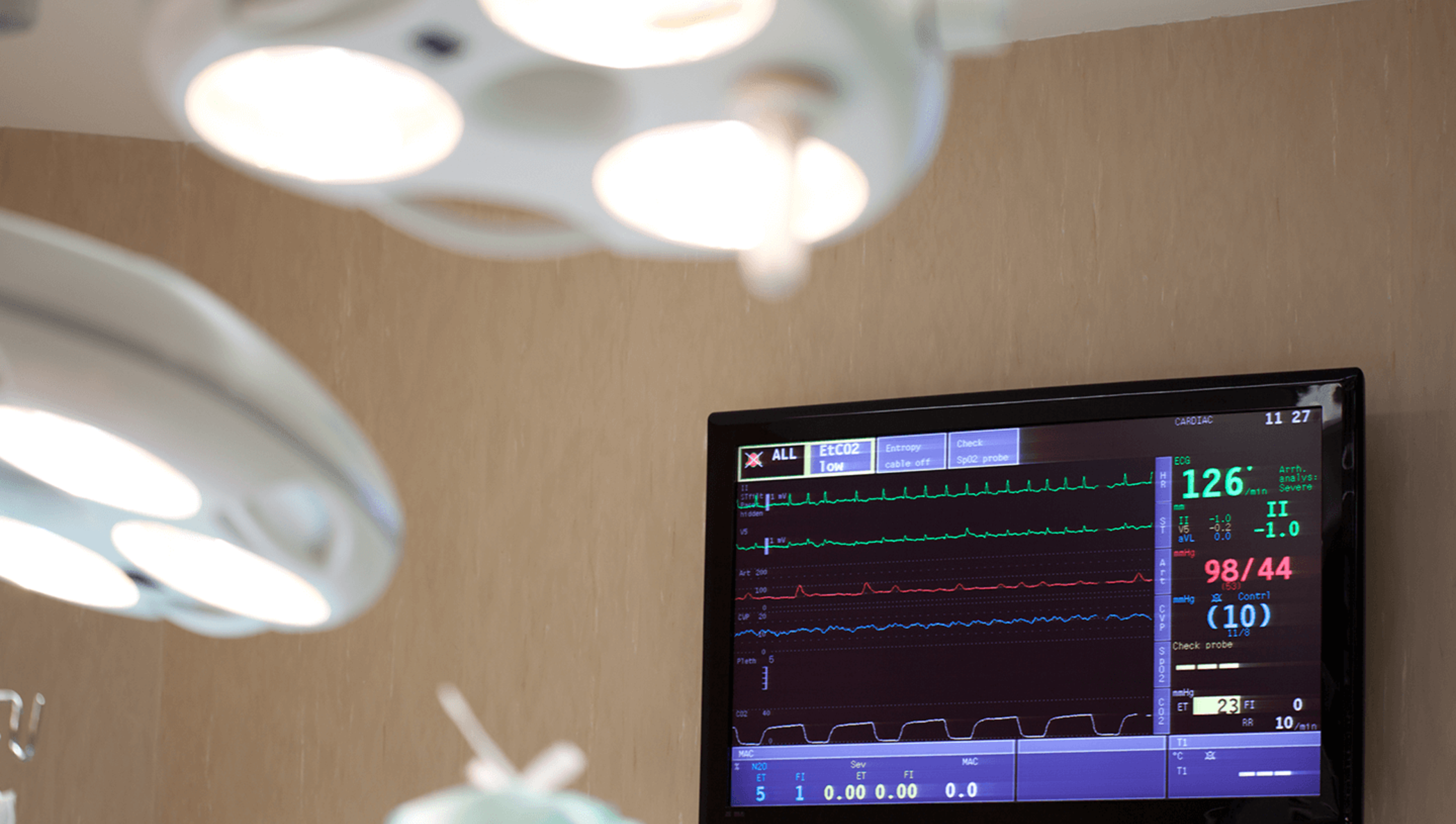 Un moniteur de fréquence cardiaque dans une chambre d'hôpital.